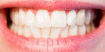Wpływ chorej tarczycy na stan zębów