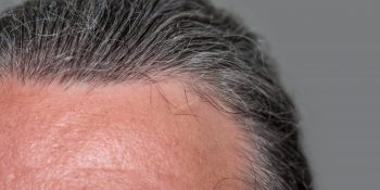 Naturalne sposoby na osłabione włosy u seniora