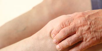 Owrzodzenia podudzi – ziołowa terapia wspierająca regenerację skóry