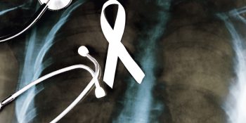 Rak płuc jako główna przyczyna zgonów z powodu chorób nowotworowych