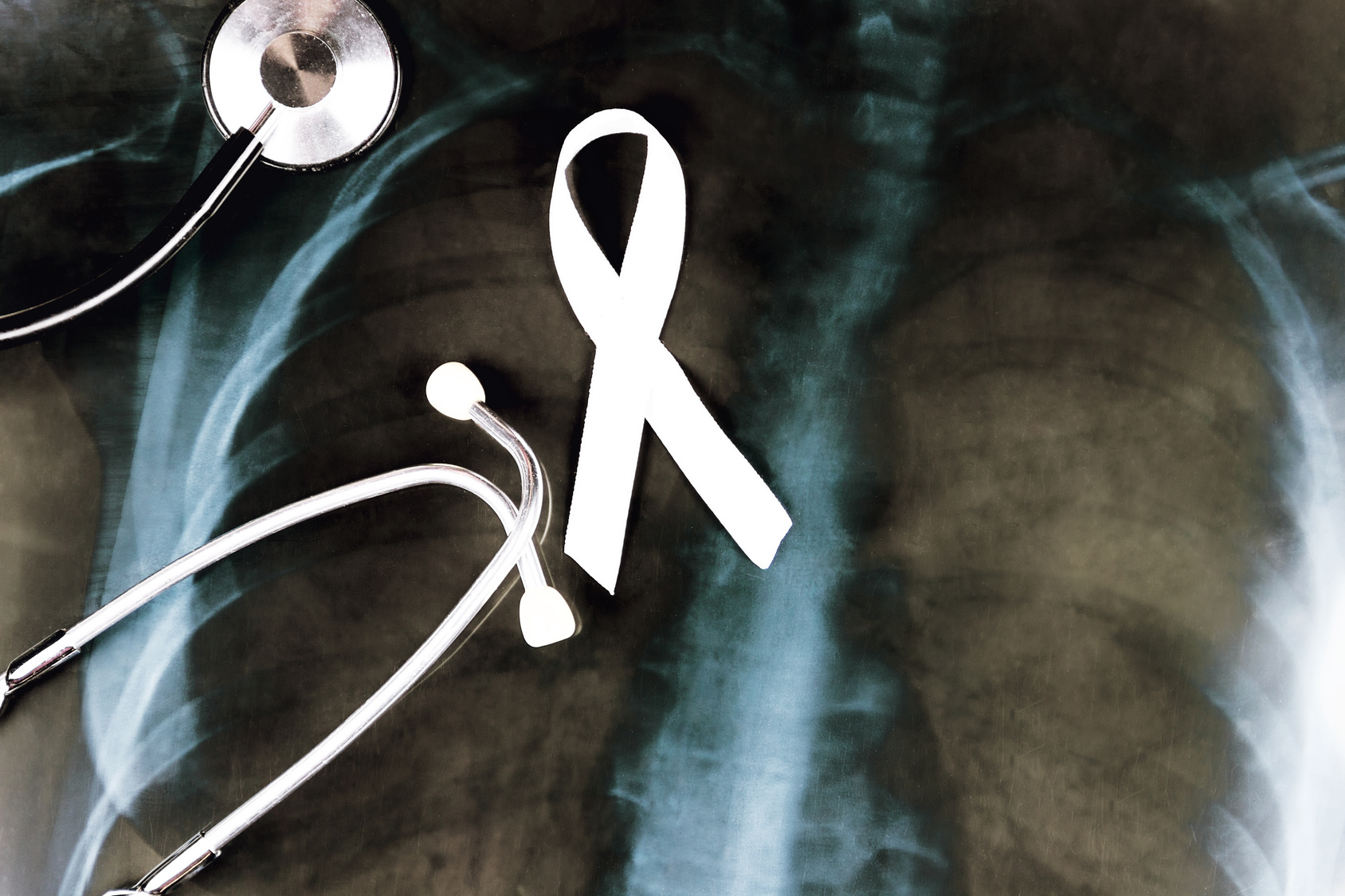 Rak płuc jako główna przyczyna zgonów z powodu chorób nowotworowych