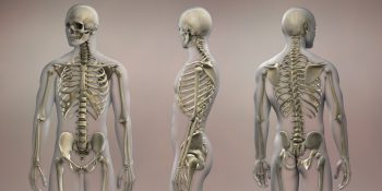 Osteoporoza jak choroba cywilizacyjna