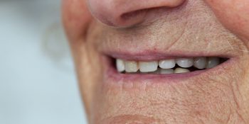 Zniszczone uzębienie – wpływ utraty zębów na układ pokarmowy