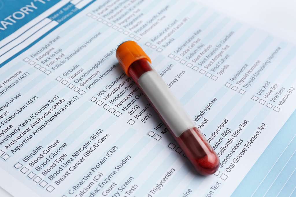 Podstawowe badanie krwi – co oznaczają skróty na wyniku