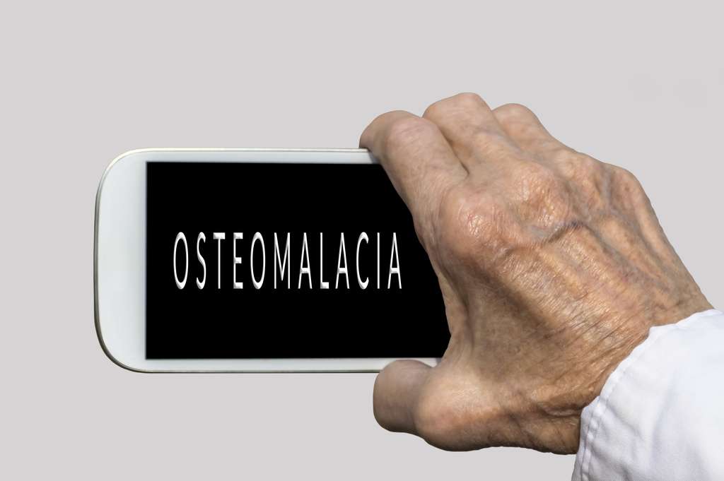 Osteomalacja – poznaj przyczyny i objawy ,,miękkich kości”!